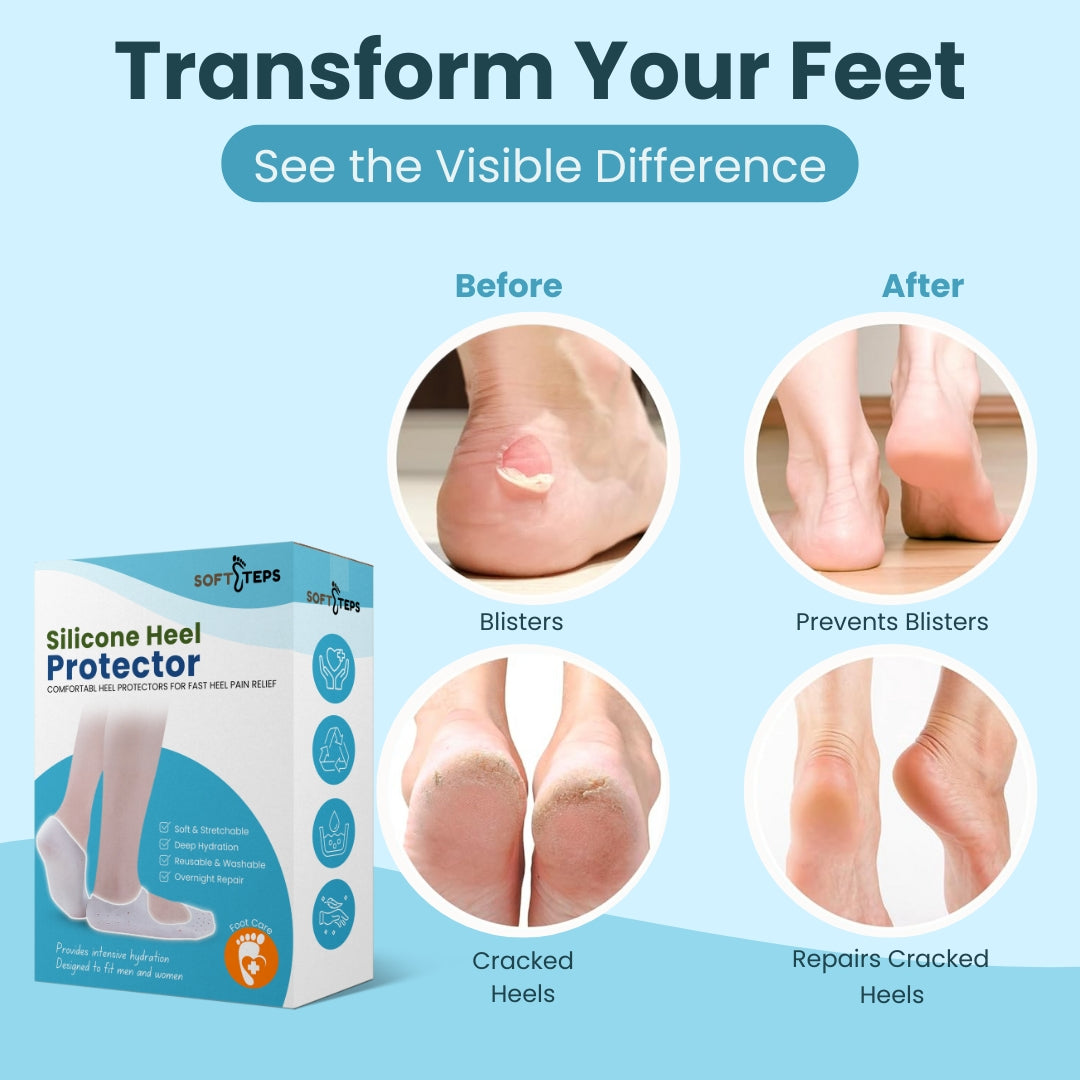Silicone Heel Protector