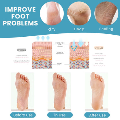 Silicone Heel Protector