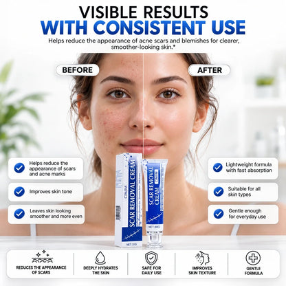 ScarSmooth- For Old Scars from Surgery, Acne, Burns