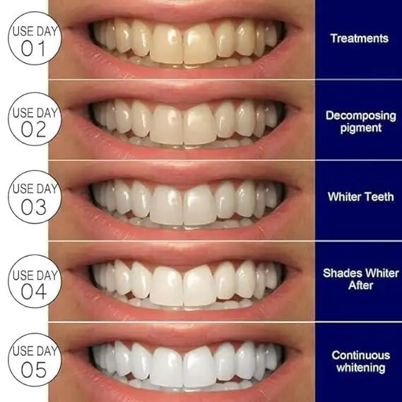 Teeth Whitening Strips Kit | Portable Dental Whitening Strips | Reduced Sensitivity White Strips for Home Use