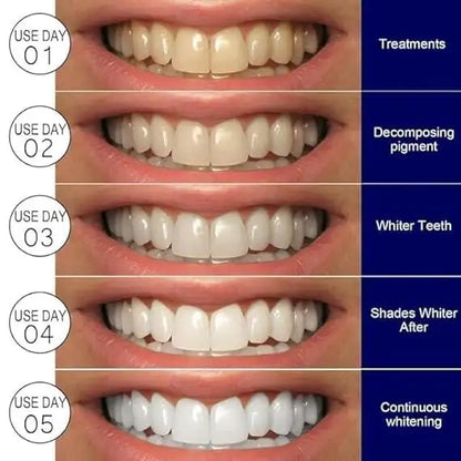 Teeth Whitening Strips Kit | Portable Dental Whitening Strips | Reduced Sensitivity White Strips for Home Use