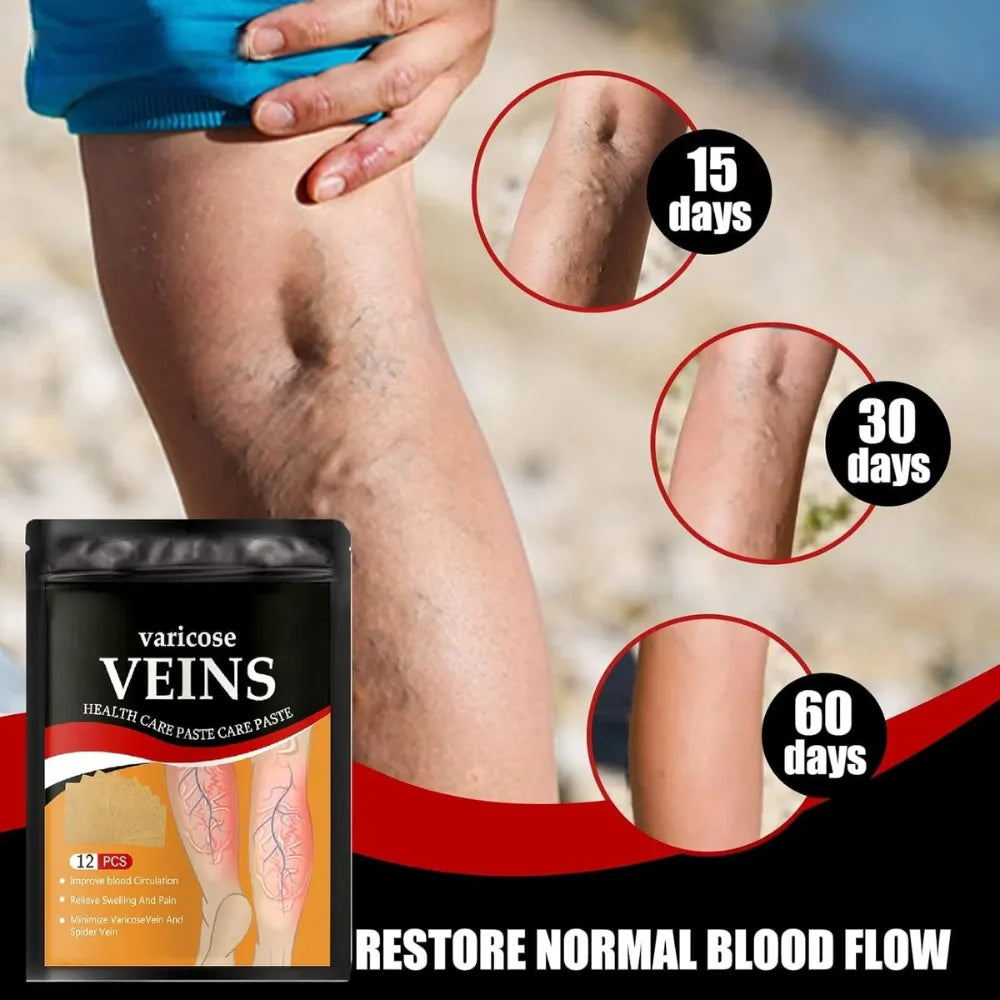 Varicose Veins Health Care Paste | Pain Relief & Blood Circulation Support
